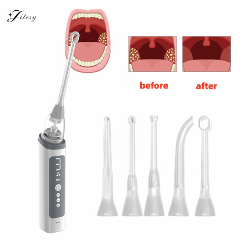 Electronic Vacuum Tonsil Stone Remover Kit with LED light 8 Suction