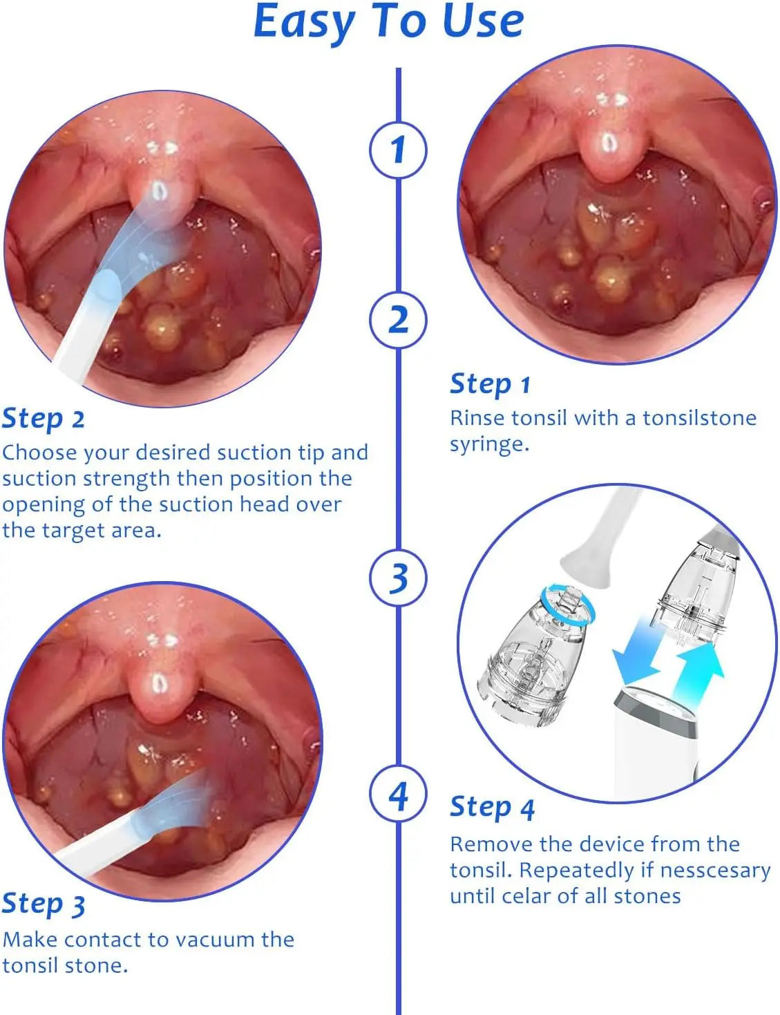 Electronic Vacuum Tonsil Stone Remover Kit with LED light 8 Suction